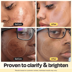 Vitamin C Clay Mask